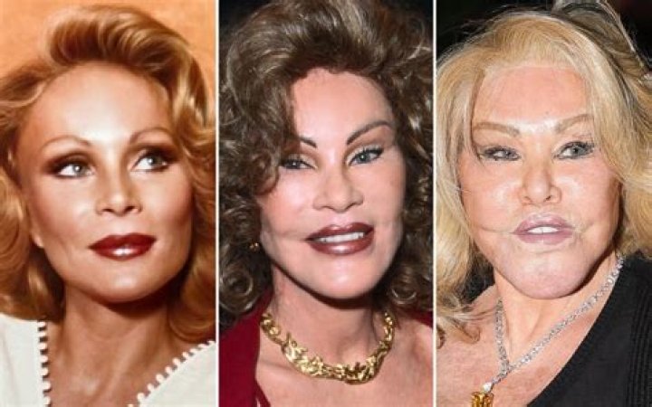 Unveiling Jocelyn Wildenstein: Beyond The Headlines